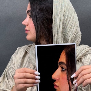 Rhinoplasty-63