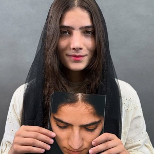 rhinoplasty-59