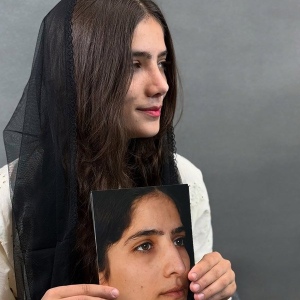 rhinoplasty-60