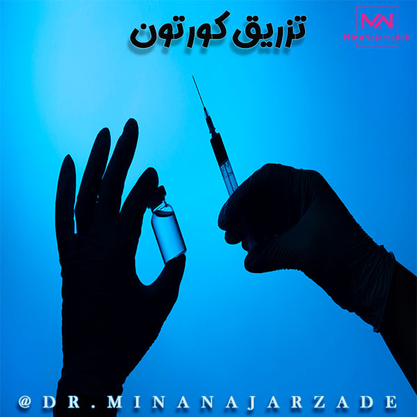تزریق کورتون بعد از جراحی بینی_دکتر مینا نجار زاده
