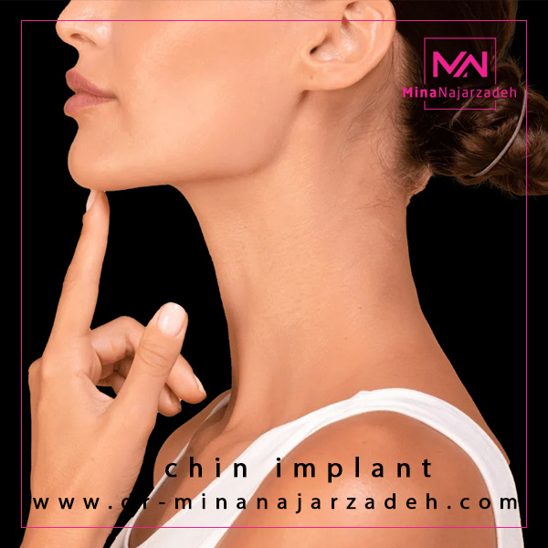 پروتز چانه در اصفهان - دکتر مینا نجارزاده