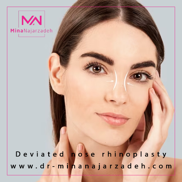 انحراف بینی - دکتر مینا نجارزاده