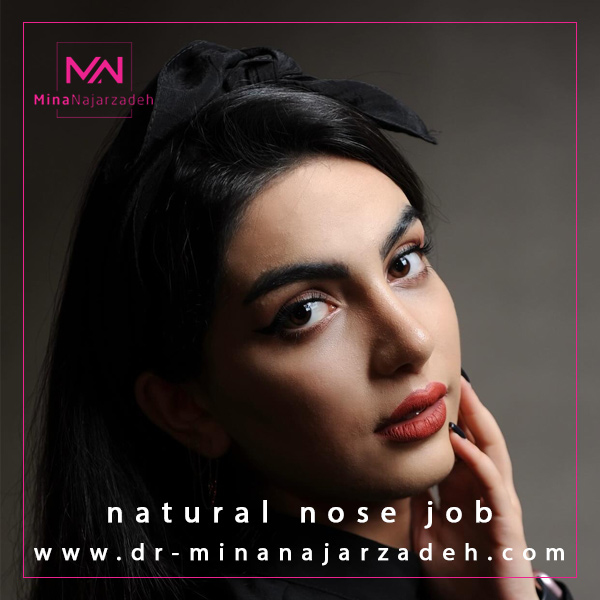 جراحی بینی طبیعی - دکتر مینا نجارزاده