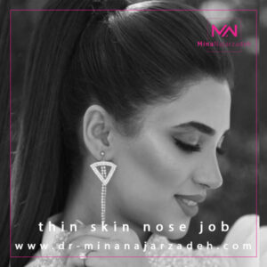 جراحی بینی استخوانی در اصفهان - دکتر مینا نجارزاده