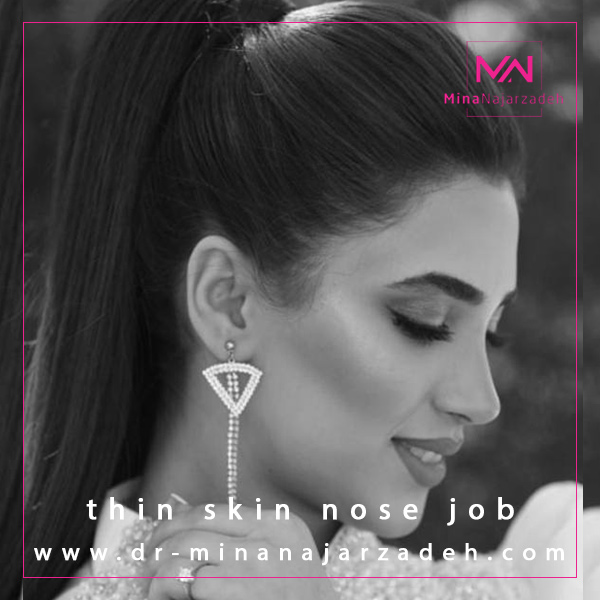 جراحی بینی استخوانی در اصفهان - دکتر مینا نجارزاده