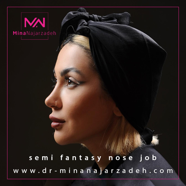 جراحی بینی نیمه فانتزی در اصفهان - دکتر مینا نجارزاده
