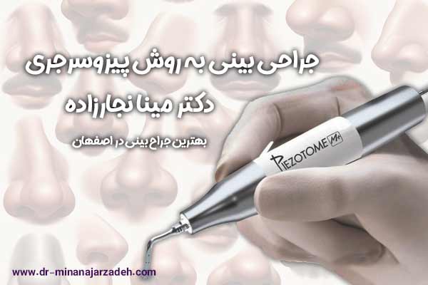 جراحی بینی به روش پیزوسرجری در اصفهان - دکتر مینا نجارزاده
