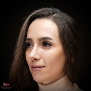 جراحی بینی استخوانی در اصفهان - دکتر مینا نجارزاده