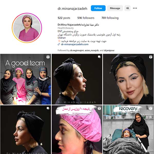 بهترین جراح بینی اصفهان - دکتر مینا نجارزاده