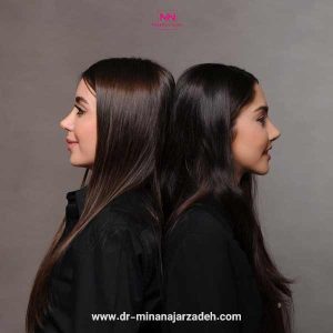 بهترین جراح بینی اصفهان - دکتر مینا نجارزاده