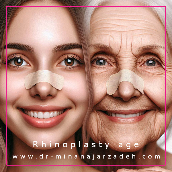 بهترین سن عمل بینی + دکتر مینا نجارزاده